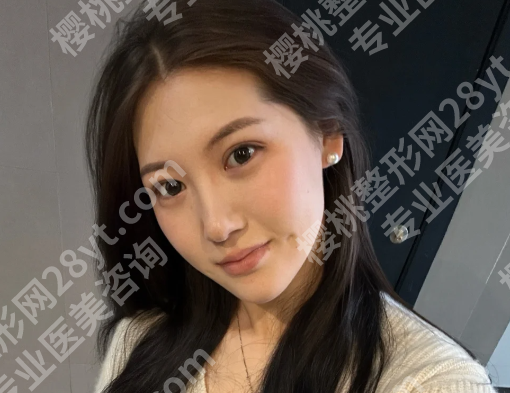 北京王光辉医生简介怎么样？含手术过程详情