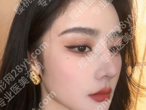 秦晓东做鼻子怎么样？内附医生口碑点评！经典案例分享！收藏再看！