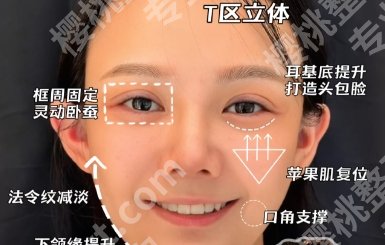 合肥拉皮整形多少钱？2025价格一览+正规医院top榜单分享！