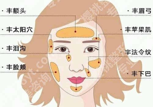 孙泽芳脂肪移植专家怎么预约？内附网友反馈、面诊小技巧