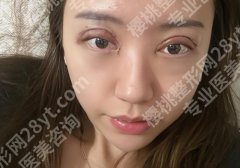 上海时光整形外科医院地址!张洪新，师瑞艳，孙育德实力推荐