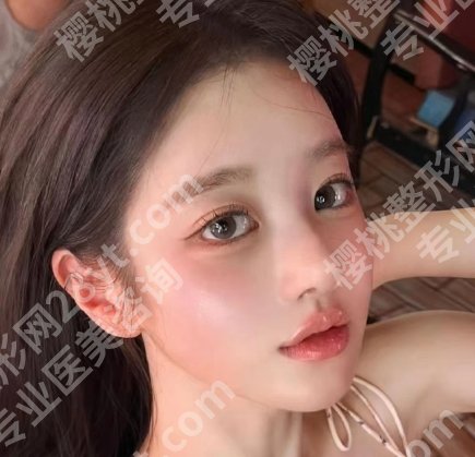 北京美莱哪个医生打水光打的好？人气医生名单+价格表更新！