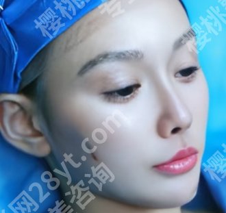 佛山拉皮整形哪家好？戳进来看真实的顾客点评吧！