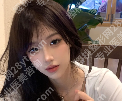 成都贾德渊鼻子价格是多少？了解医生资料与案例过程分享