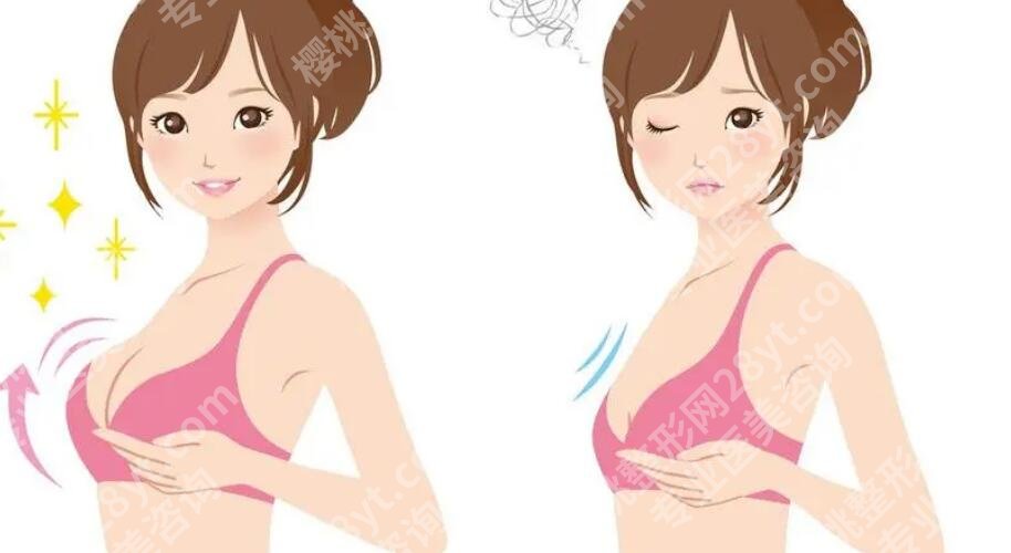 李如杰医生资料来袭！隆胸技术、口碑以及真人案例展示！