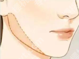 高俊明医生从业多少年？磨骨风格、口碑点评、真人案例来袭！