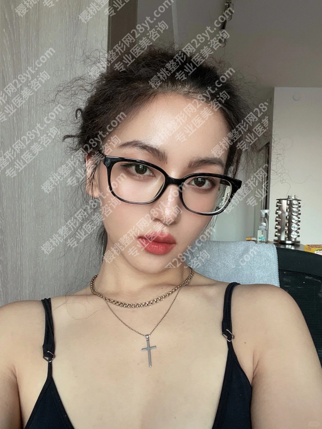 深圳面部吸脂医院排行名单！深圳市人民医院、美莱、鹏爱凭实力上榜