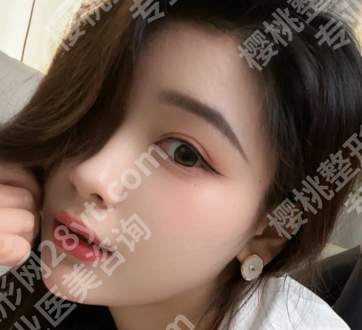 李成成医生口碑咋样？速看预约方式和案例详情了解