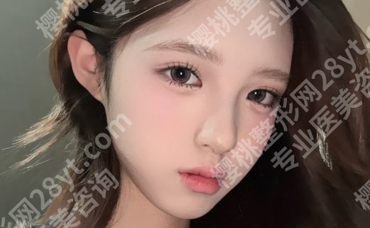 河东镐案例真实顾客反馈！磨骨后逆袭成了妈生少女颜