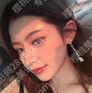 上海六院整形科的医生名单更新！郑江红、杨松林凭实力上榜！