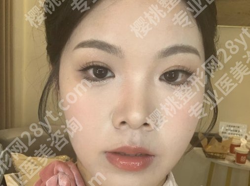复旦大学附属儿科医院整形外科李军怎么样？耳鼻畸形、唇腭裂经验多