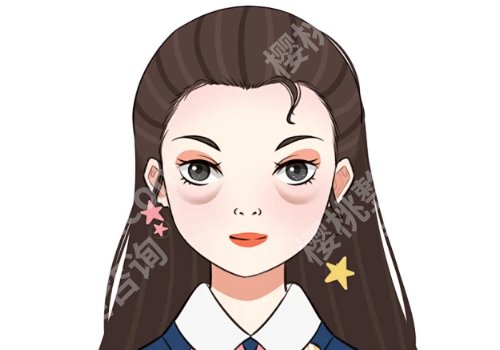 李东医生祛眼袋案例!明星项目和案例鉴赏