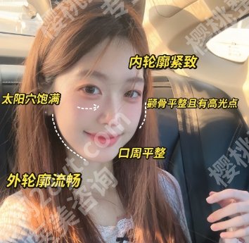 张笑天在哪家医院？戳进来看真实的网友反馈吧！