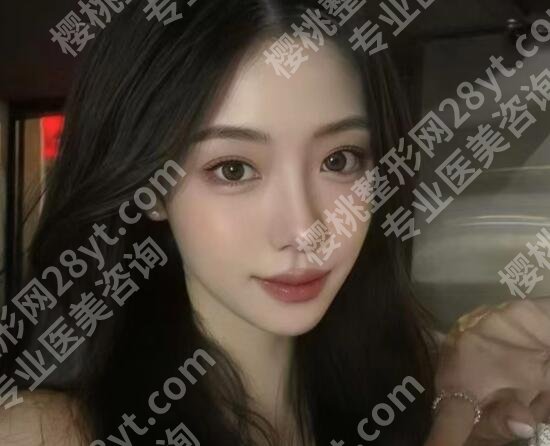 北京蒂凡妮做双眼皮怎么样？医院口碑评价|案例展示！