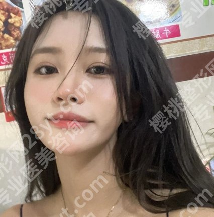 上海六院做双眼皮手术多少钱？医院口碑测评、医生名单公布！
