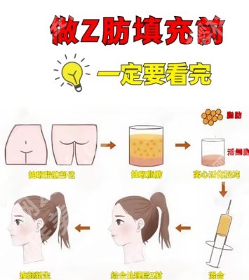 南京吴国平自体脂肪填充的技术好不好？坐诊医院基本信息分享