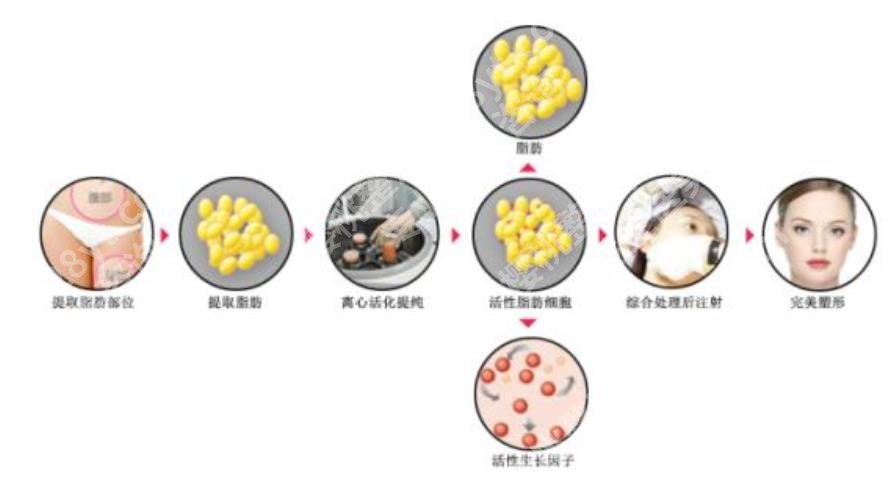 深圳哪里做脂肪填充技术好？当地公立和私立医院名单汇总！