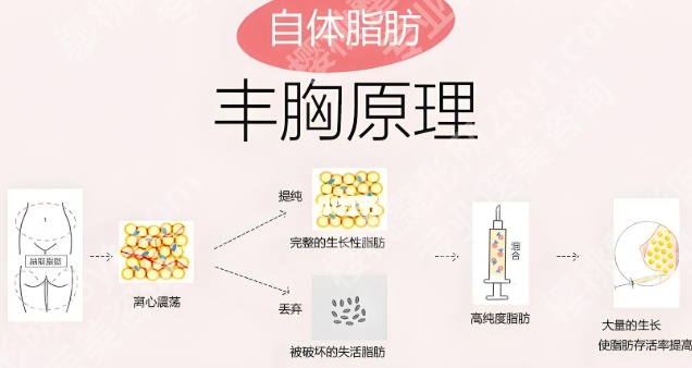 赵广生医生隆胸怎么样？了解个人医生信息_含面诊过程