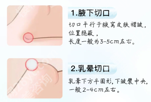 沈正宇医生隆胸怎么样？个人信息在线了解_附案例过程