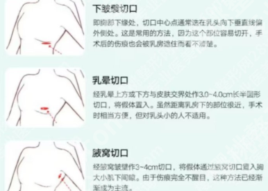 河南省人民医院隆胸哪个医生比较好？了解医生资料，含挂号方式一览