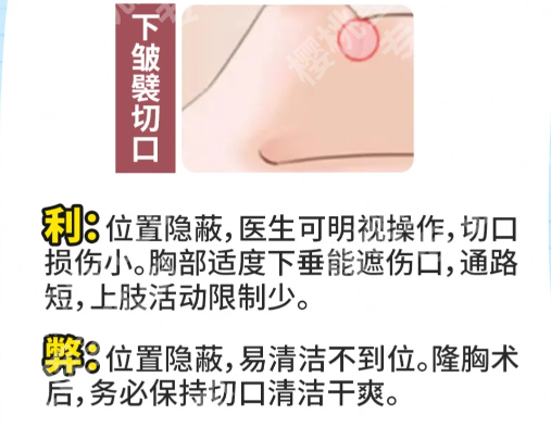 上海第九人民医院隆胸医生梁拥军简介怎么样？速看医生人气项目_含小建议详情