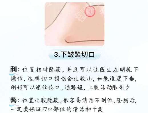 上海同济医院隆胸多少钱？附费用标准和医院预约方式分享