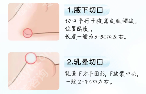 宿州市立医院隆胸专家有哪些？速看热门医生和挂号方式点击收藏