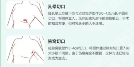 温州徐海艇是正规医院吗？一键查看医生资料，分享面诊过程