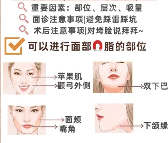 深圳面吸医生相关介绍！袁巍巍、范锟铻、朱辉等医生通通上榜！收藏再看！