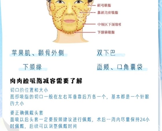 广州面吸医生十大排名新鲜出炉！医院简介及医院人气医生推荐！速速收藏！