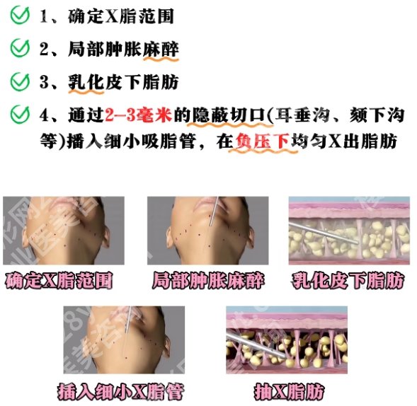 北京面部吸脂好的专家是谁？真实客户口碑来袭！来看相关介绍！