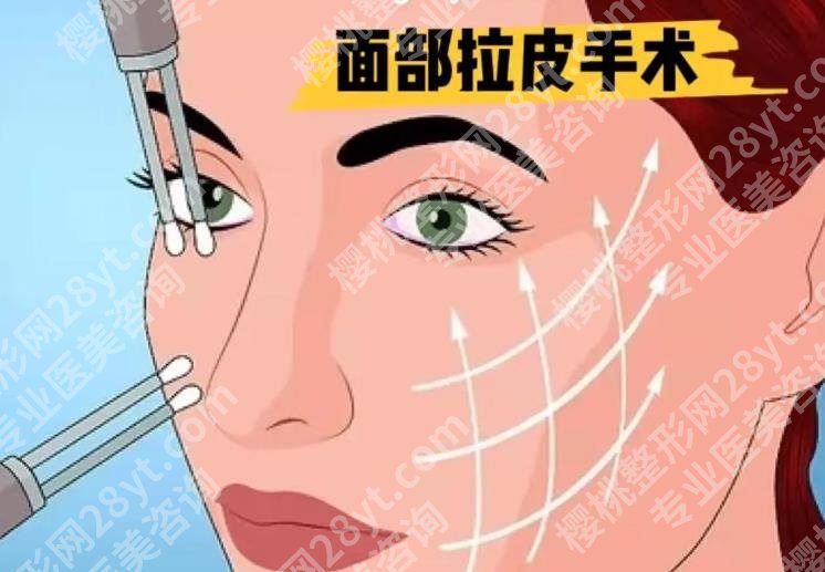 北京杜太超拉皮价格贵不贵？个人面诊过程及案例分享！