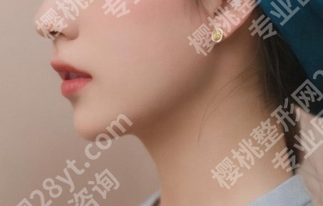 黄大勇磨骨价格贵不贵？坐诊医院及面部整形项目疑问解答！