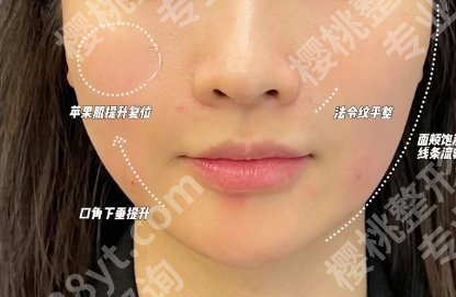北京李晓东拉皮技术好吗？关于医生的真人案例测评来袭！