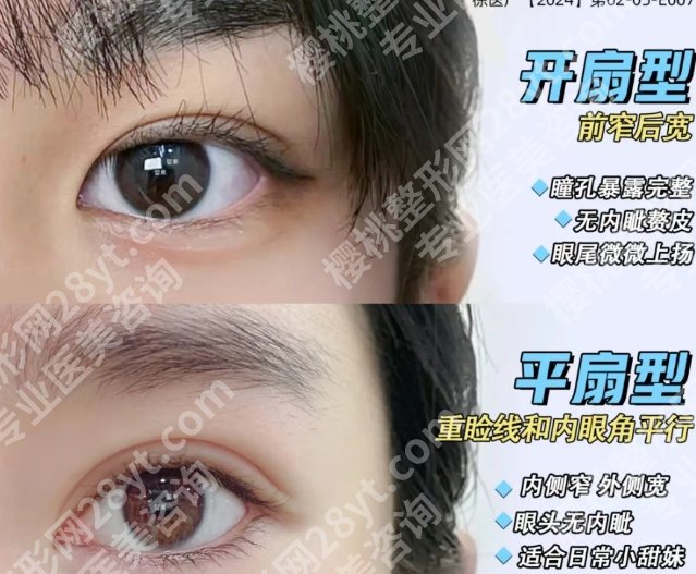 陈志兵医生双眼皮技术如何？面诊过程一览，案例一一查看