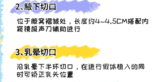 成都华西医院隆胸多少费用多少？速看人气医生信息，挂号攻略了解