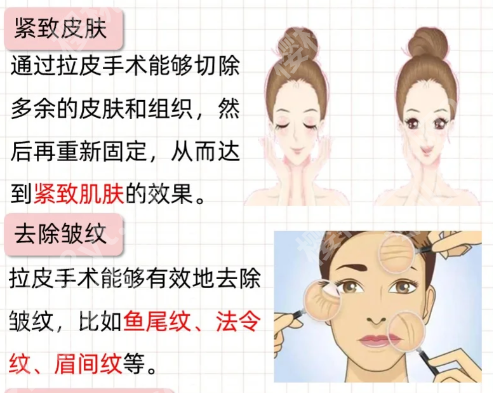 北京高亚东拉皮手术怎么样？含医生信息，附有面诊流程详情