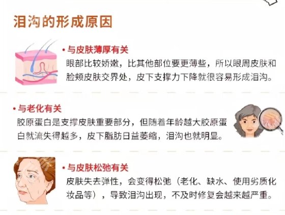 哈尔滨瑞丽哪个做泪沟做得好？戳进来看详细介绍！附真实口碑分享！