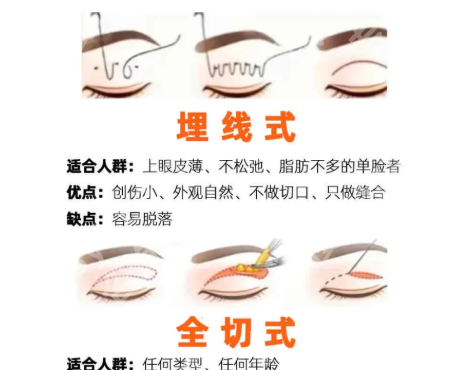 南宁双眼皮韩志强怎么样？口碑医生信息与面诊流程了解