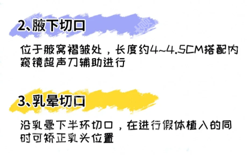 孙家明医生会做脂肪隆胸吗？速看医生资料，公布案例过程