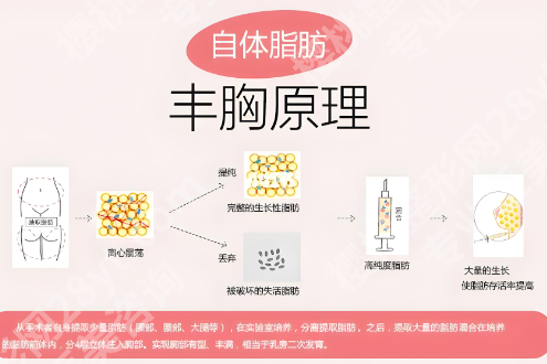 海南西部中心医院隆胸多少钱？假体隆胸41982元起
