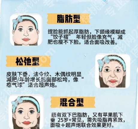 佛山面部吸脂医院哪家好？top榜前五名单更新！收藏再看！