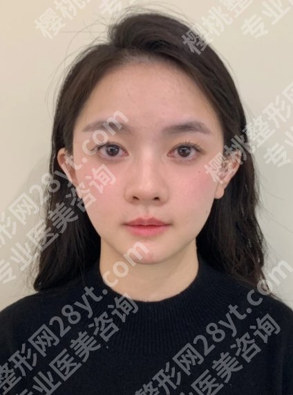 北京焦虎医生在哪坐诊？真实案例及面诊攻略一览