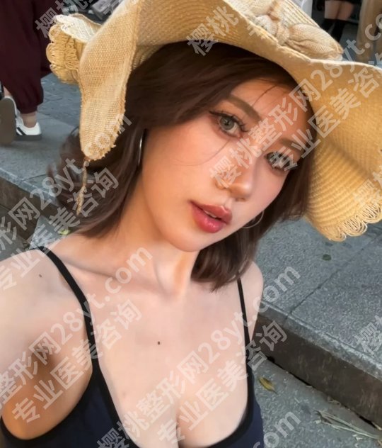 辛敏强手术做得怎么样？附基本信息及网友体验反馈