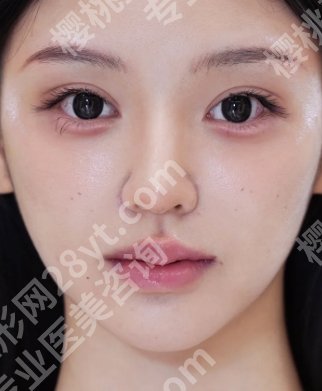 上海九院毕晓萍简介公开！内附医生技术点评、口碑点评、真实案例鉴赏