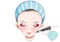 北京301医院激光科张佳莹怎么样？网友反馈、科室是展示