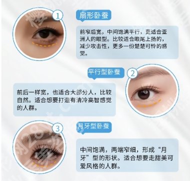 魏志香卧蚕再造案例图片展示！来看前后差别！戳进来看