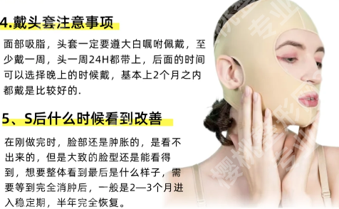 西安面吸手术谁做的好？口碑好的医生一一了解