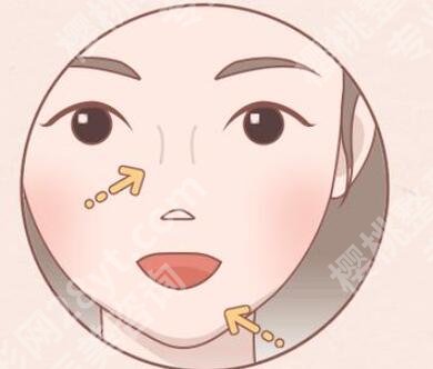 朱金成脂肪做的怎么样？如何挑选医生，实力点击查看