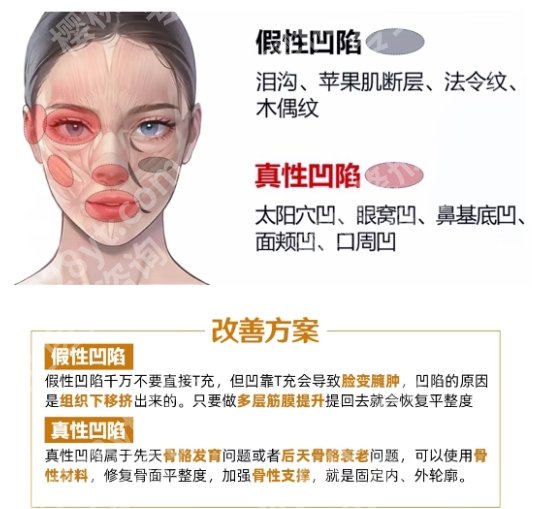 王世虎做筋膜提升怎样？效果怎么样？院内医生相关介绍！就诊必看！